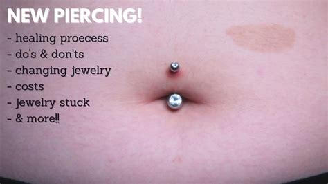 What to Know and Do About Navel Stones